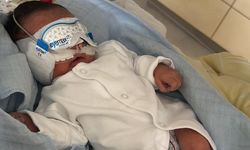 Mikel bebek gözleri olmadan dünyaya geldi