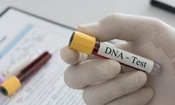 Babalık testi masrafı eşit paylaşılacak