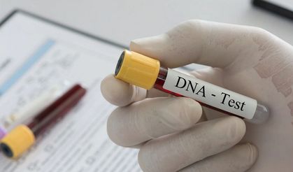 Babalık testi masrafı eşit paylaşılacak