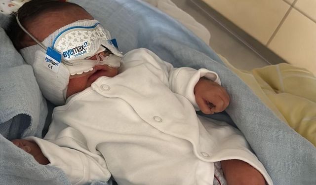 Mikel bebek gözleri olmadan dünyaya geldi