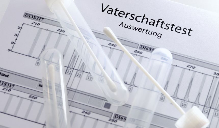 Babalık testi masrafı eşit paylaşılacak