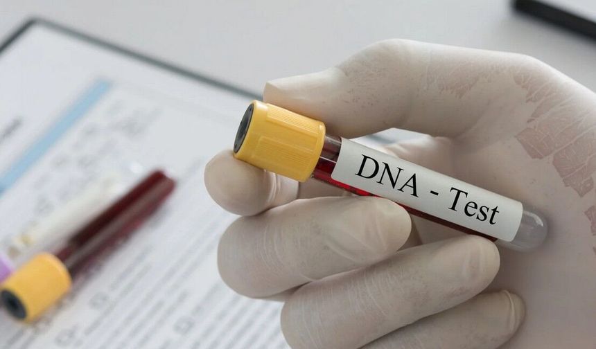 Babalık testi masrafı eşit paylaşılacak